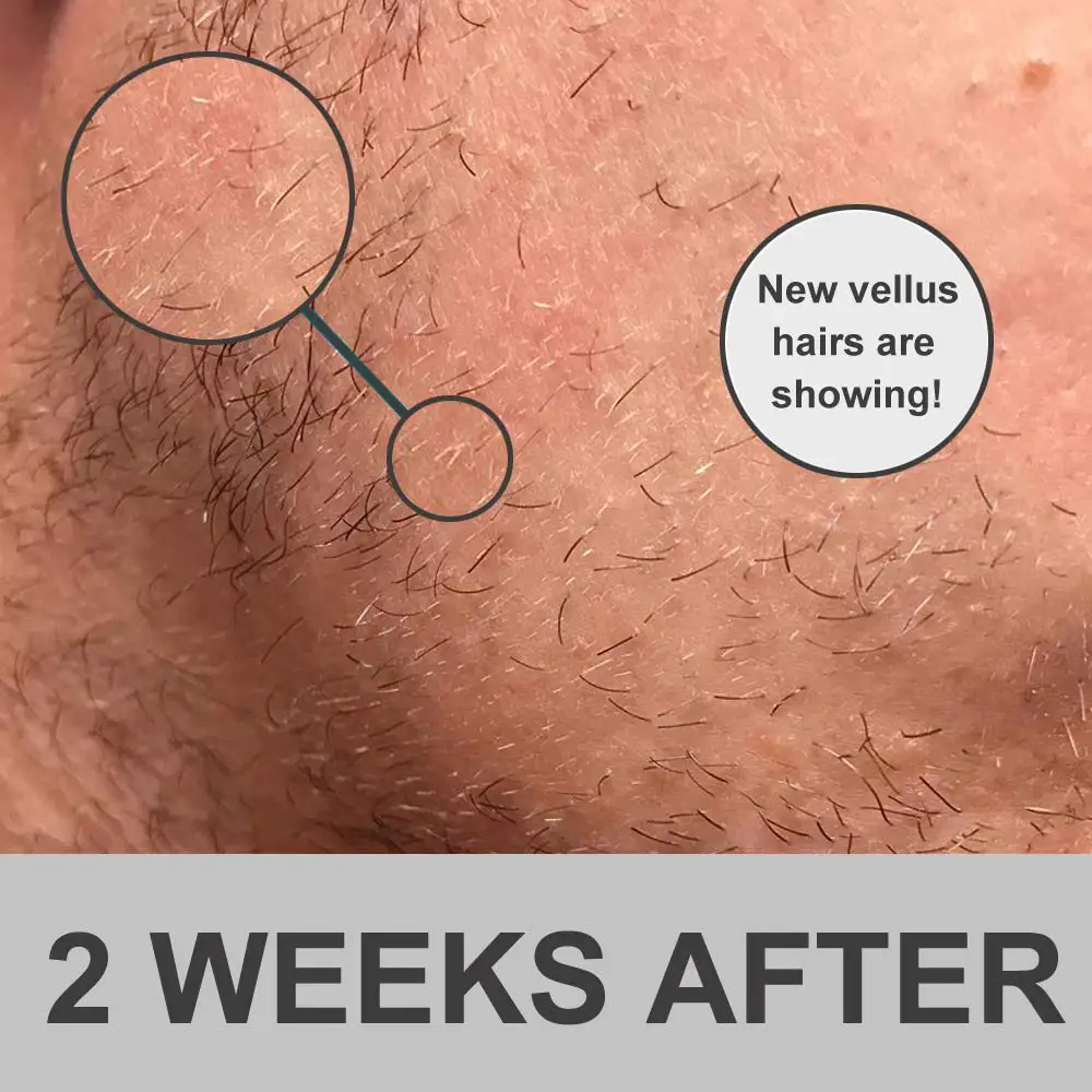 Custom 2 Pcs Men Beard Care Products Set Private Label Organic Grooming Beard Oil Kit For Roller Growth