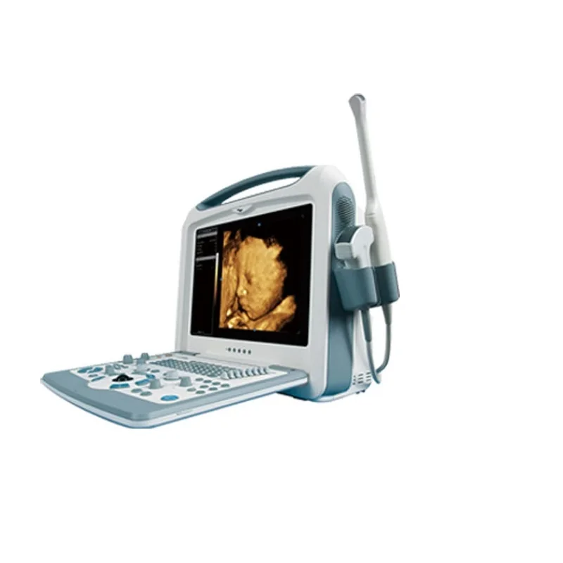 High Accuracy Factory price   CE Approved  medical  Ultrasound Scanner
