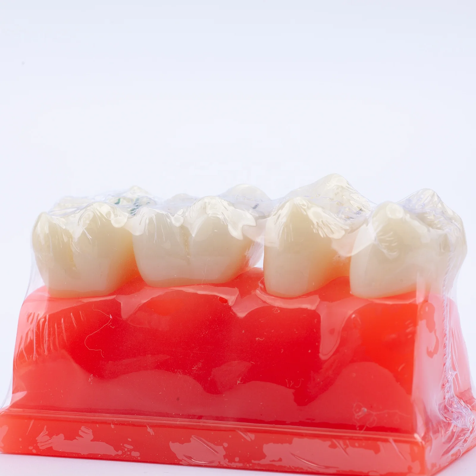 Pit and Fissure Sealant Teeth Model Demonstration Dental Model for for Patients Communication and Education