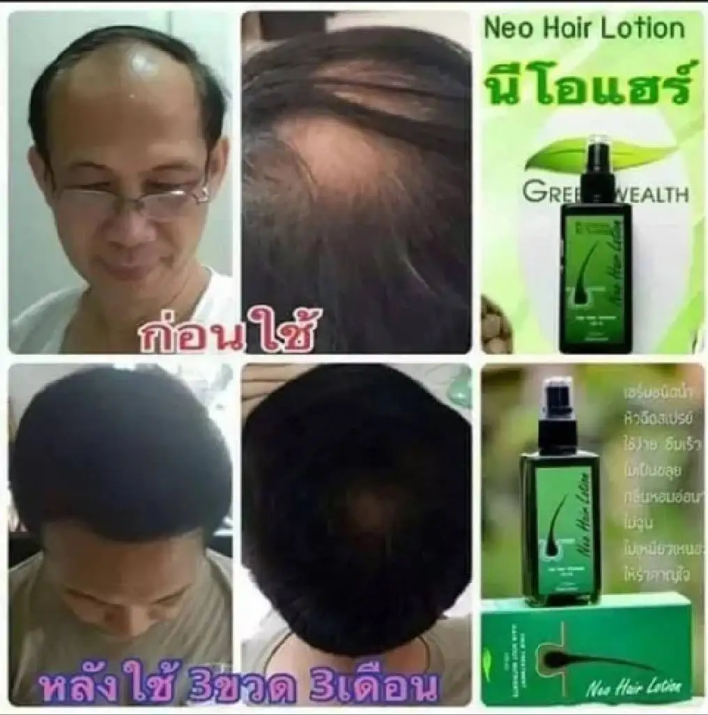 Hot Sell 120ML Neo Hair Lotion Green Wealth Thailand fast growth hair oil for men and women anti hair loss