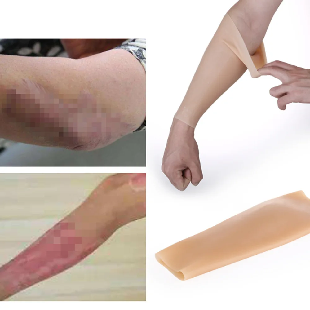 O-shaped Leg Pad Spiral Leg Pad Corrector for Arm and Calf Injuries Birthmark Blocking Silicone Plump Leg Cover