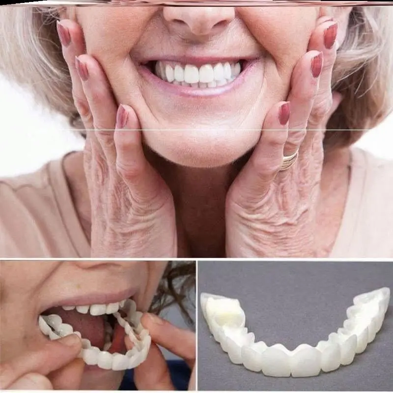 Popular Snap smile customized Perfect Smile teeth Upper lower False teeth cover Denture socket on sale