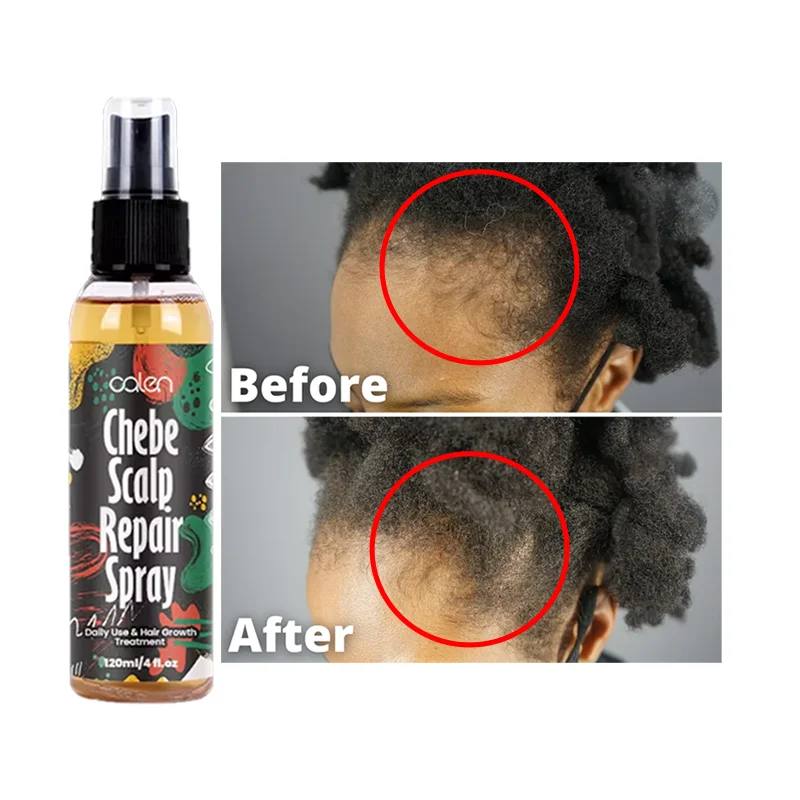 OALEN ODM Stimulate Hair Growth Chebe Oil Spray Nourishing Chebe Hair Spray Thinning 120ML Hair Growth Oil