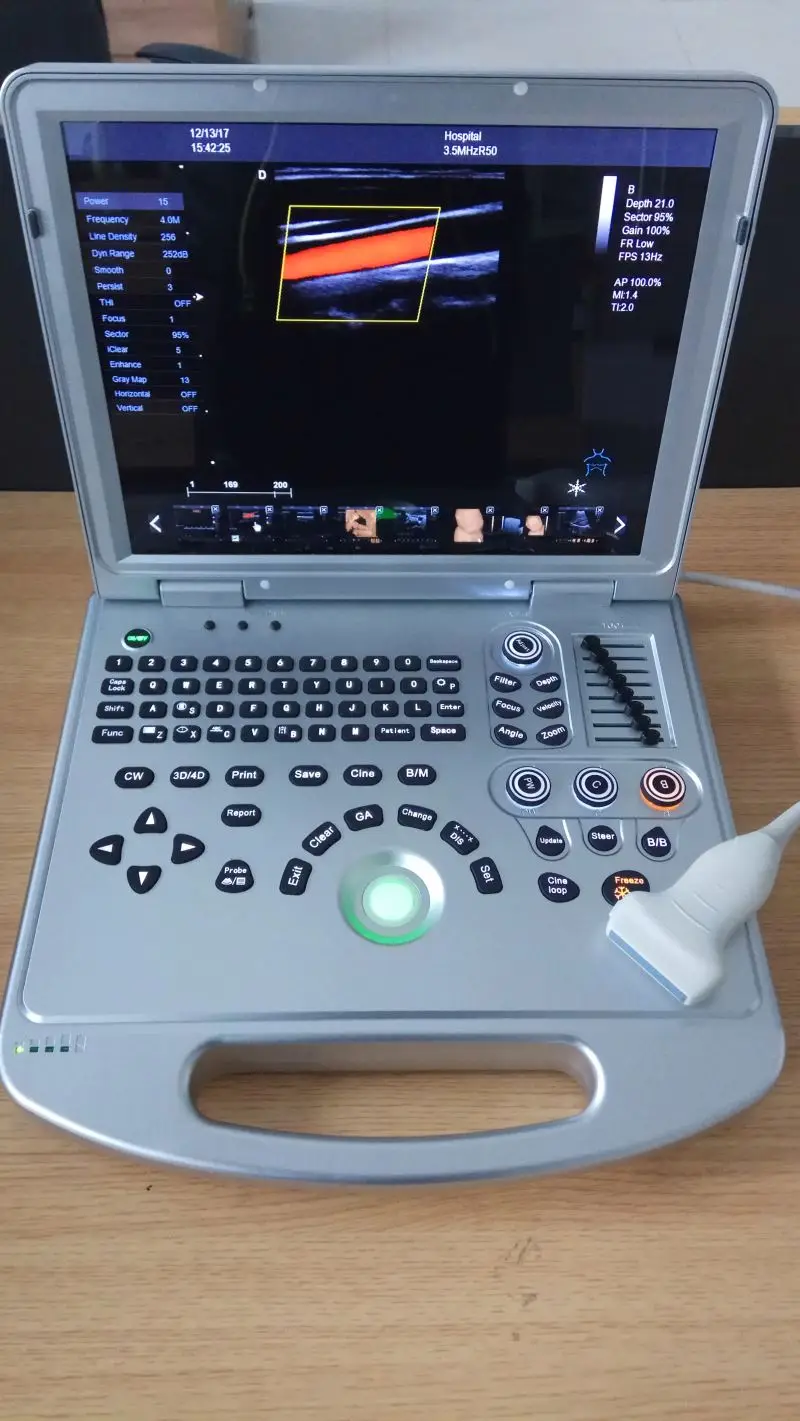 Usg machine 4d  3d ultrasound machine digital portable doppler ultrasound price