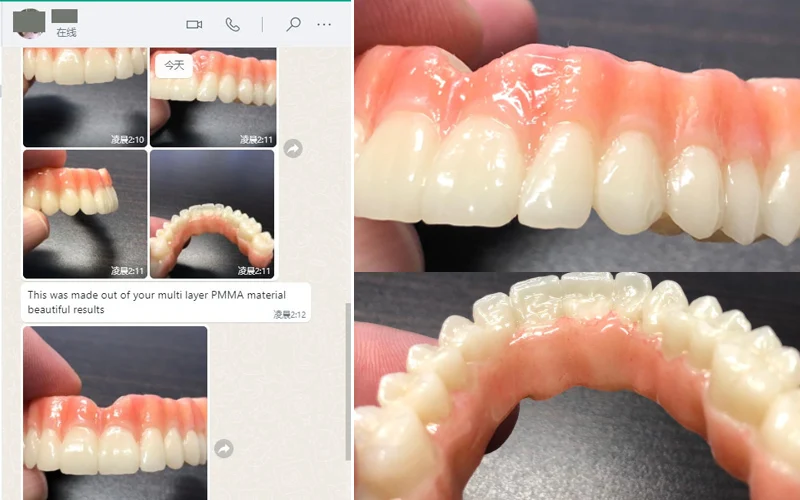 98MM Dental PMMA Block and Flexible Acetal Disc for Dental Labs | CAD CAM Milling Multilayer Dental Resin Block