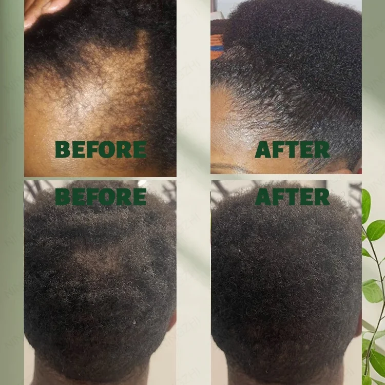 Wholesale natural organic hair care anti hair loss essence ginger hair growth serum