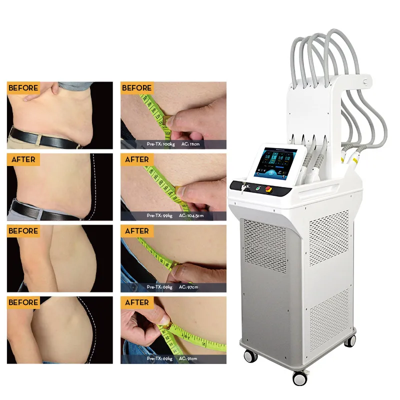 Multifunction Lipo Laser Weight Loss Fat Removal Cell Slimming For Wellness Centers