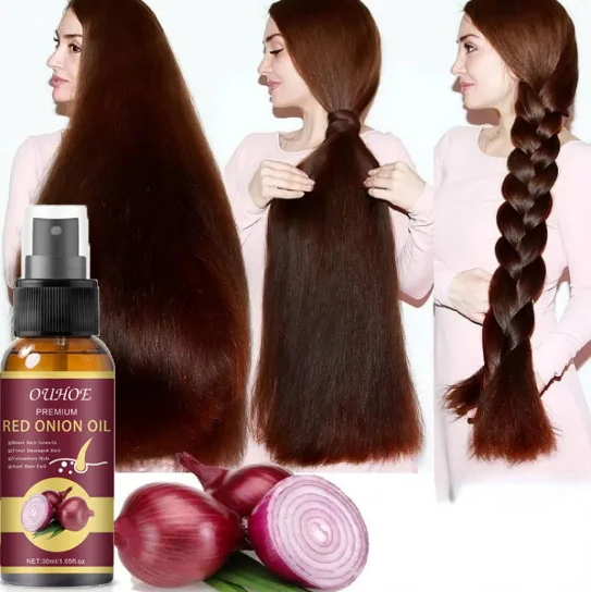 Hair Grouth Fast Onion Black Seed Essential Oils Oil Spray for Hair Care and Growth To Prevent Hair Loss
