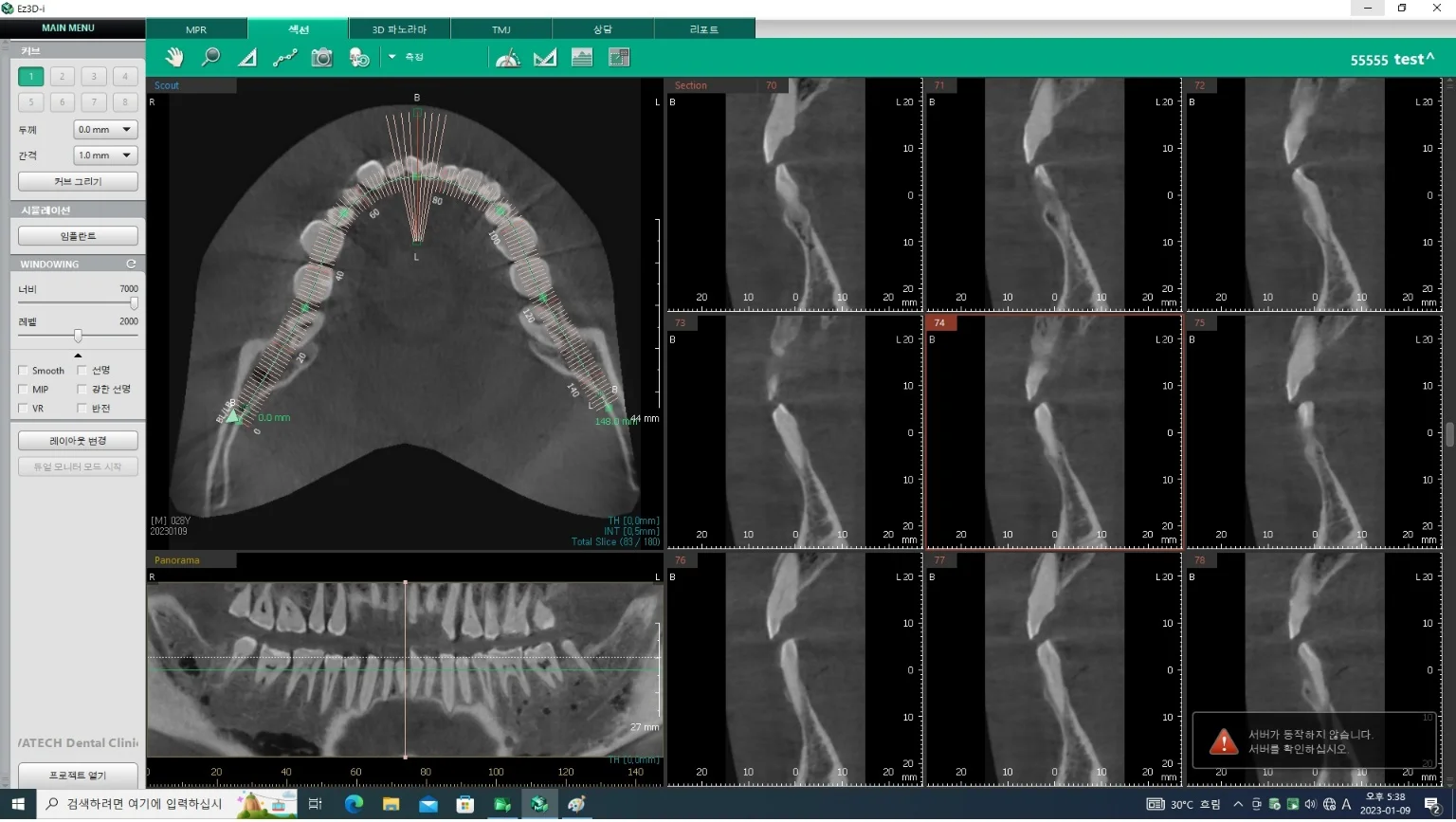 USED DIGITAL CT PANORAMIC DENTAL X-RAY SYSTEM w/wo CEPHALO UNIT