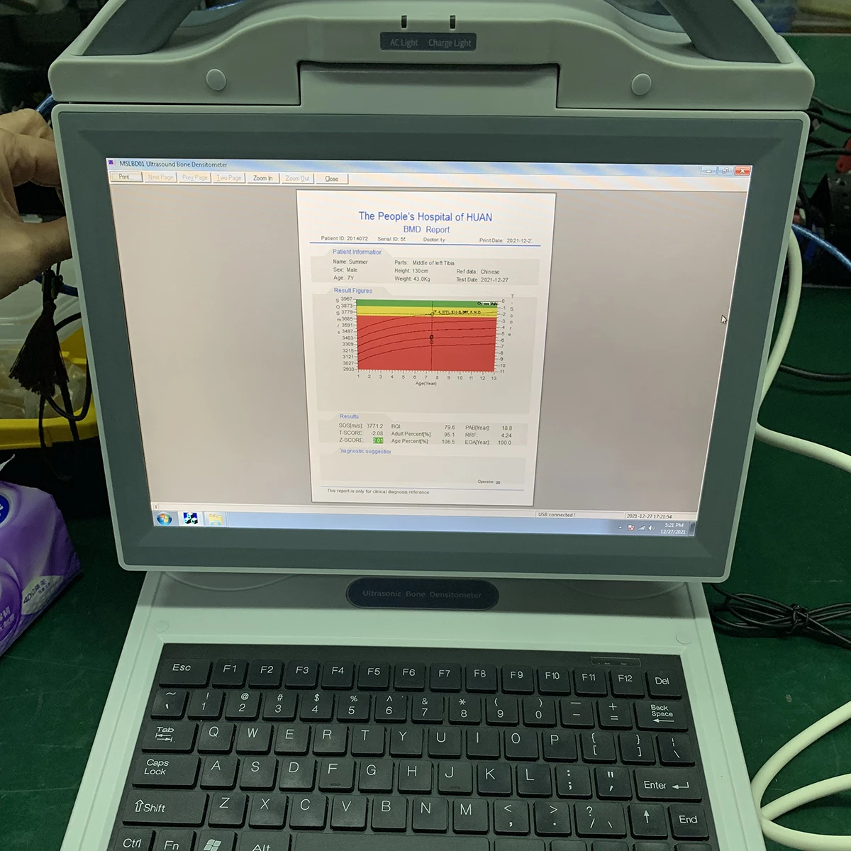 Portable and popular radial and tibia bone densitometer MSLBD14