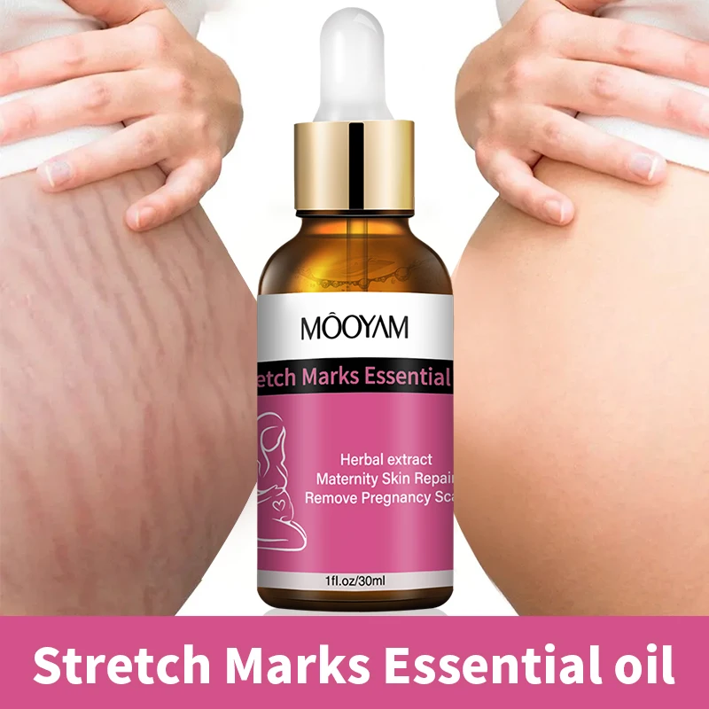 Private label OEM ODM reduce anti pregnancy stretch Pregnant belly stretch marks removal Pregnancy mark oil