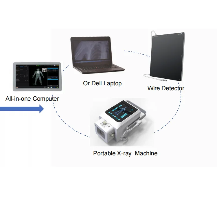 10.4 inch 8.0kw xray with optional flat panel detector x-ray portable x ray rechargeable