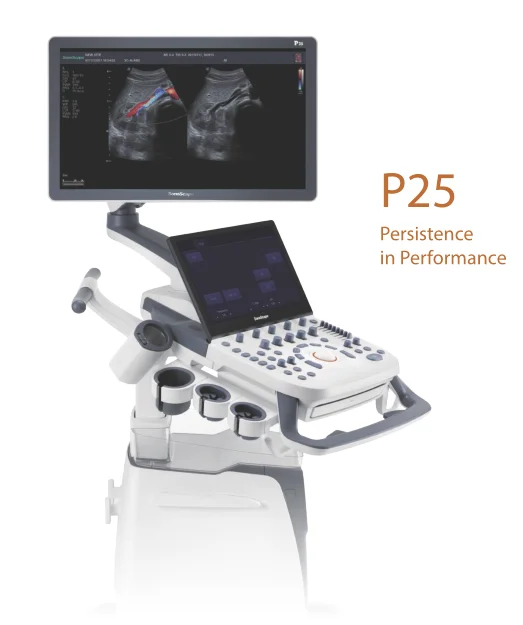Trolley Color Doppler ultrasound scanner 3D/4D sonoscape P25 machine with a good price.