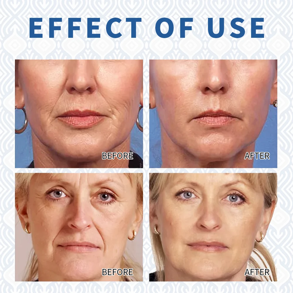 Private Label Best Sellers Organic Collagen With Hyaluronic Acid Custom Logo Face Skincare Retinol Serum