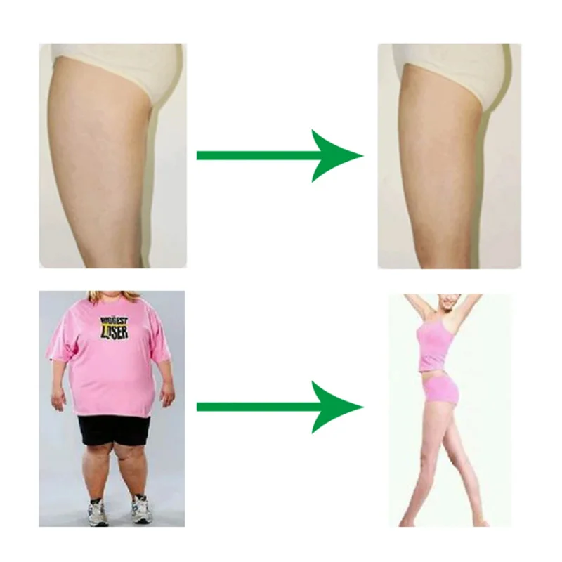 The Price Of Slimming Products For Weight Loss Flat Belly Fat Burning Weight Loss Set