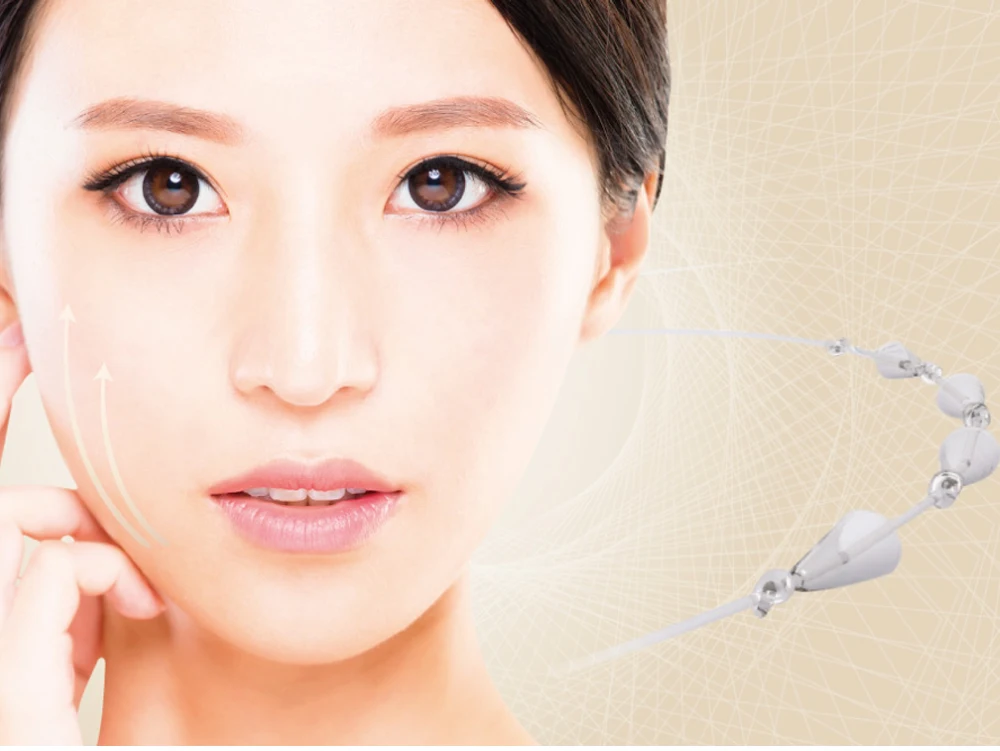 Pdo plla facial lifting thread 8cones silhouette thread soft lift fishbone cog for face brow neck buttock lifting