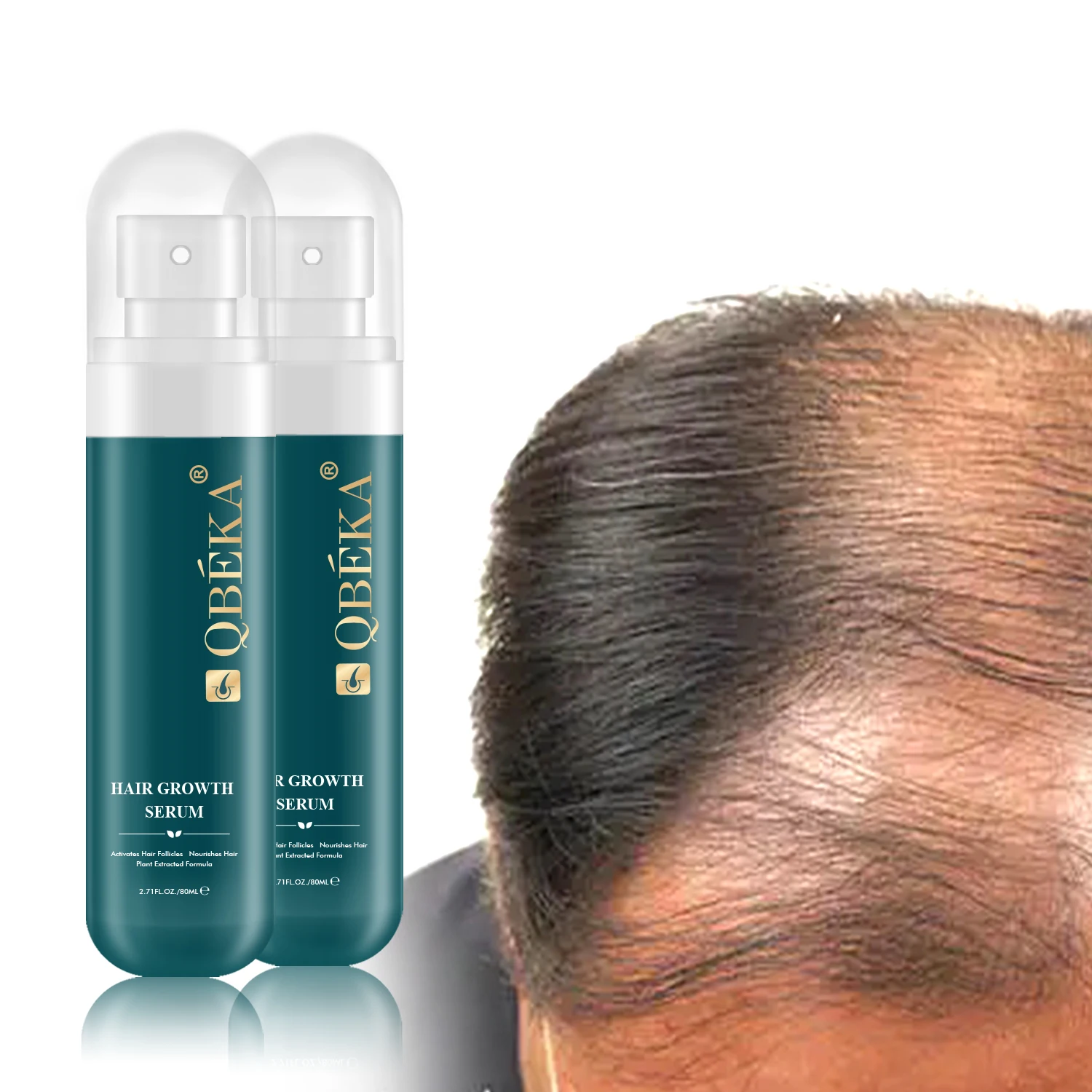 Anti Loss Serum Hair Growth Oil Alopecia Hair Loss for Enhance Hair Grows