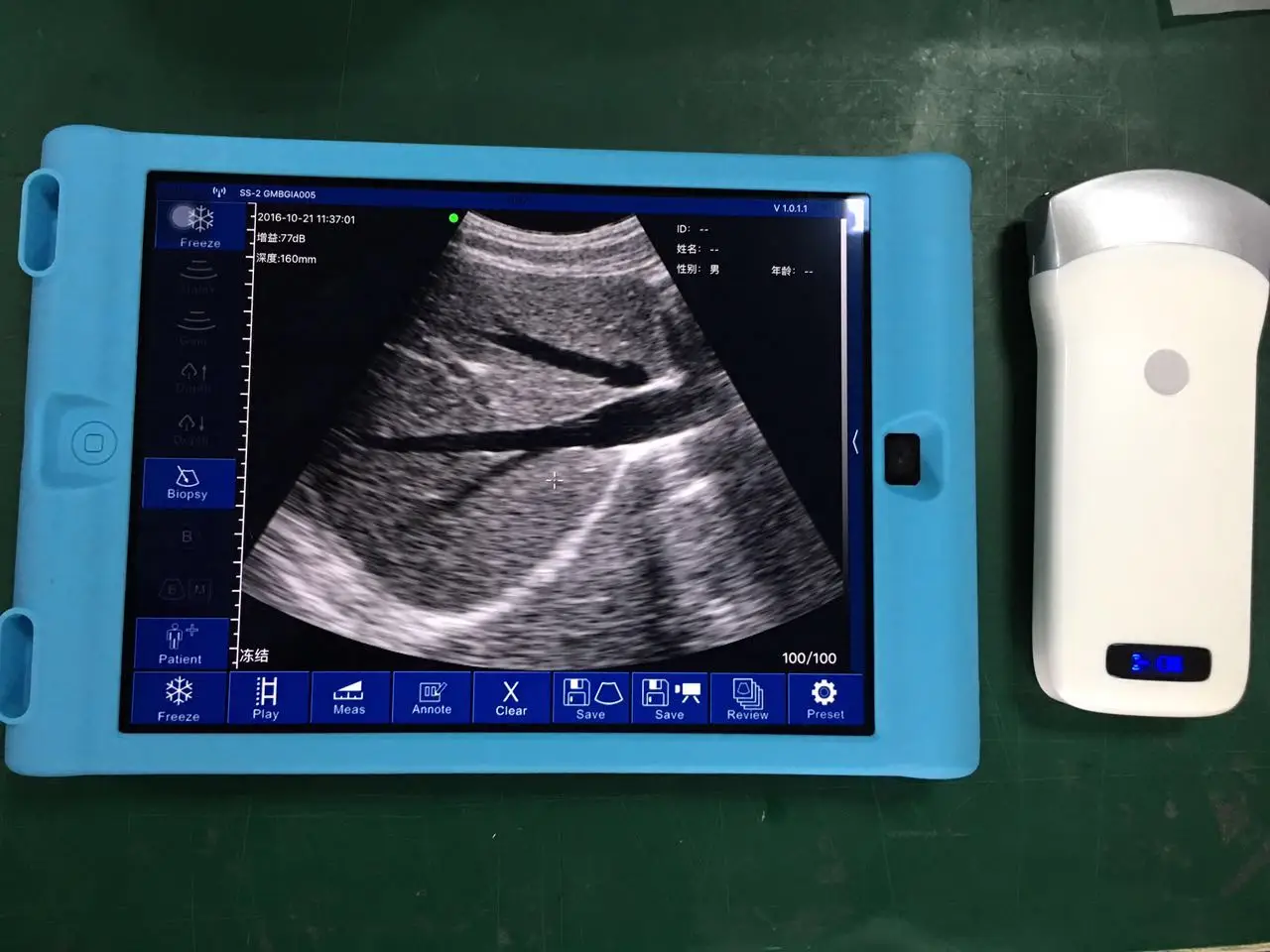 wireless android/ios convex array usb ultrasound probe ultrasound scanner pocket ultrasound for sale price