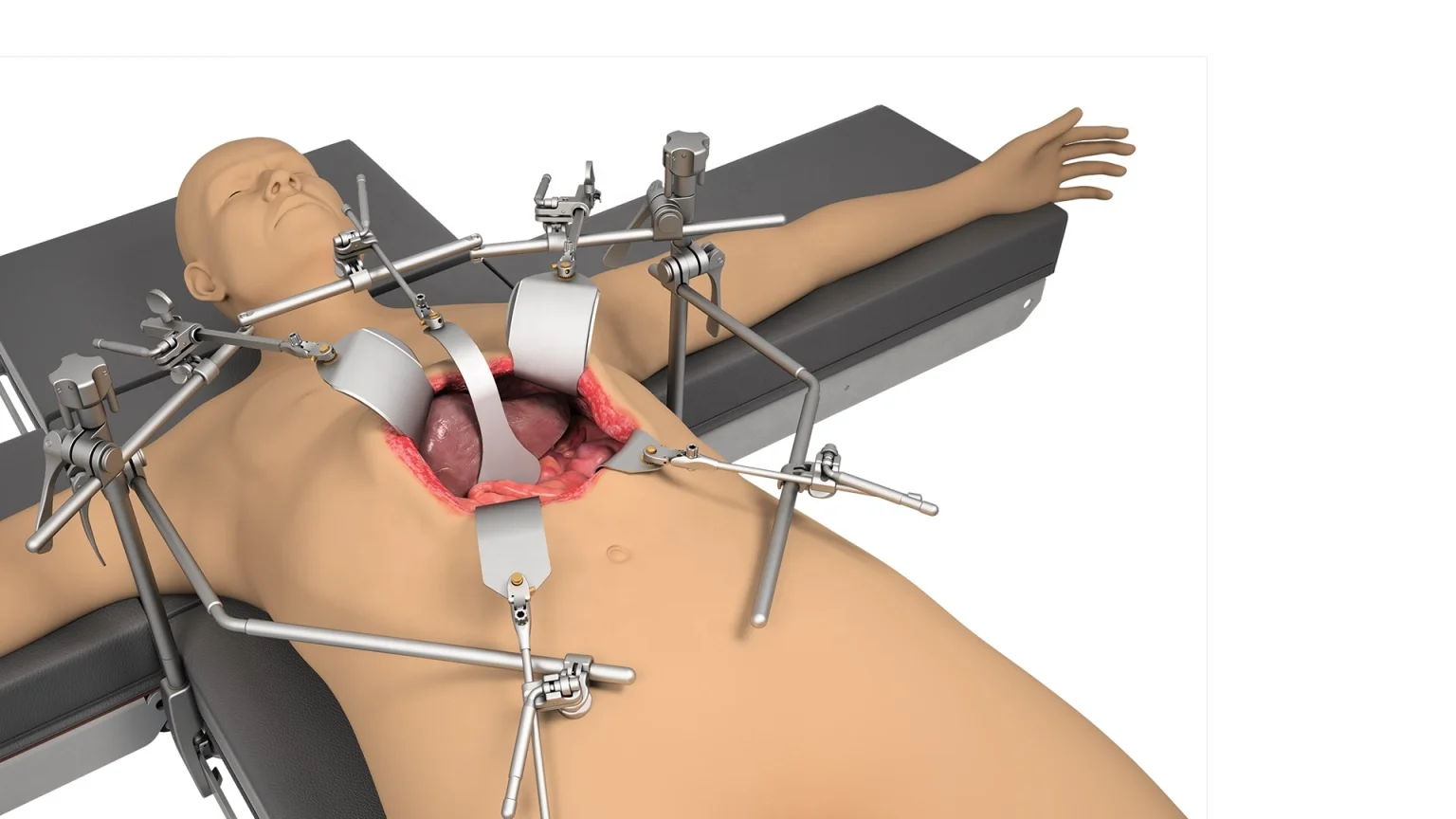 Hot Sale Buy Online High Quality Stainless Steel Top Value Professional Thompson Retractor Set Liver Transplant