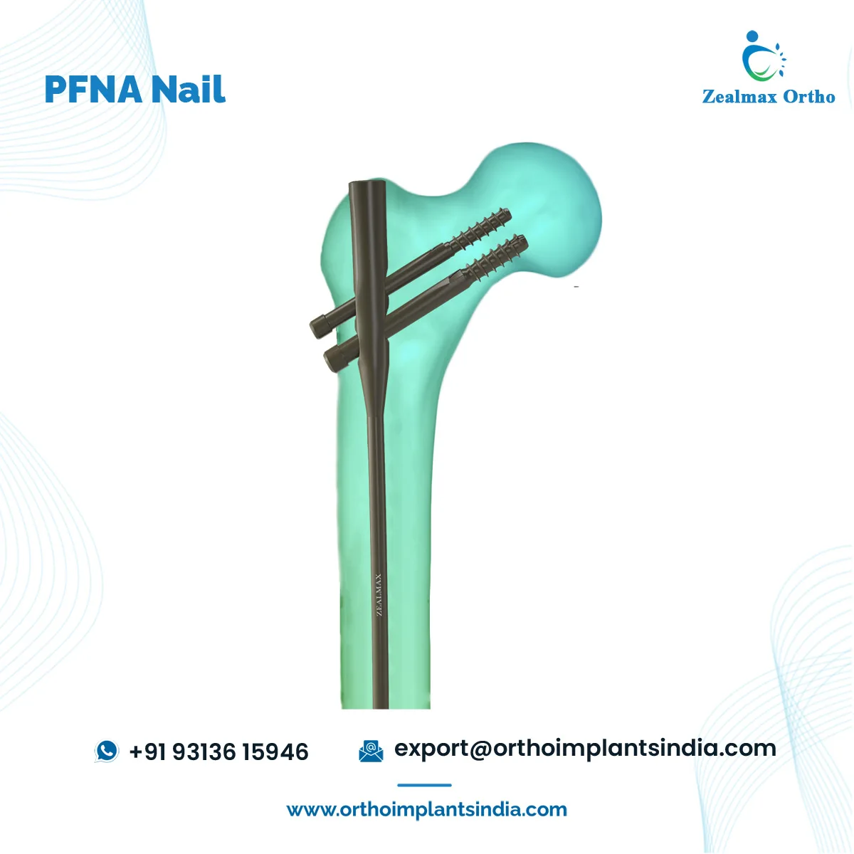 Zealmax Ortho Orthopedic Trauma Implants High Quality Pure Titanium Material PFNA Femoral Intramedullary Nail