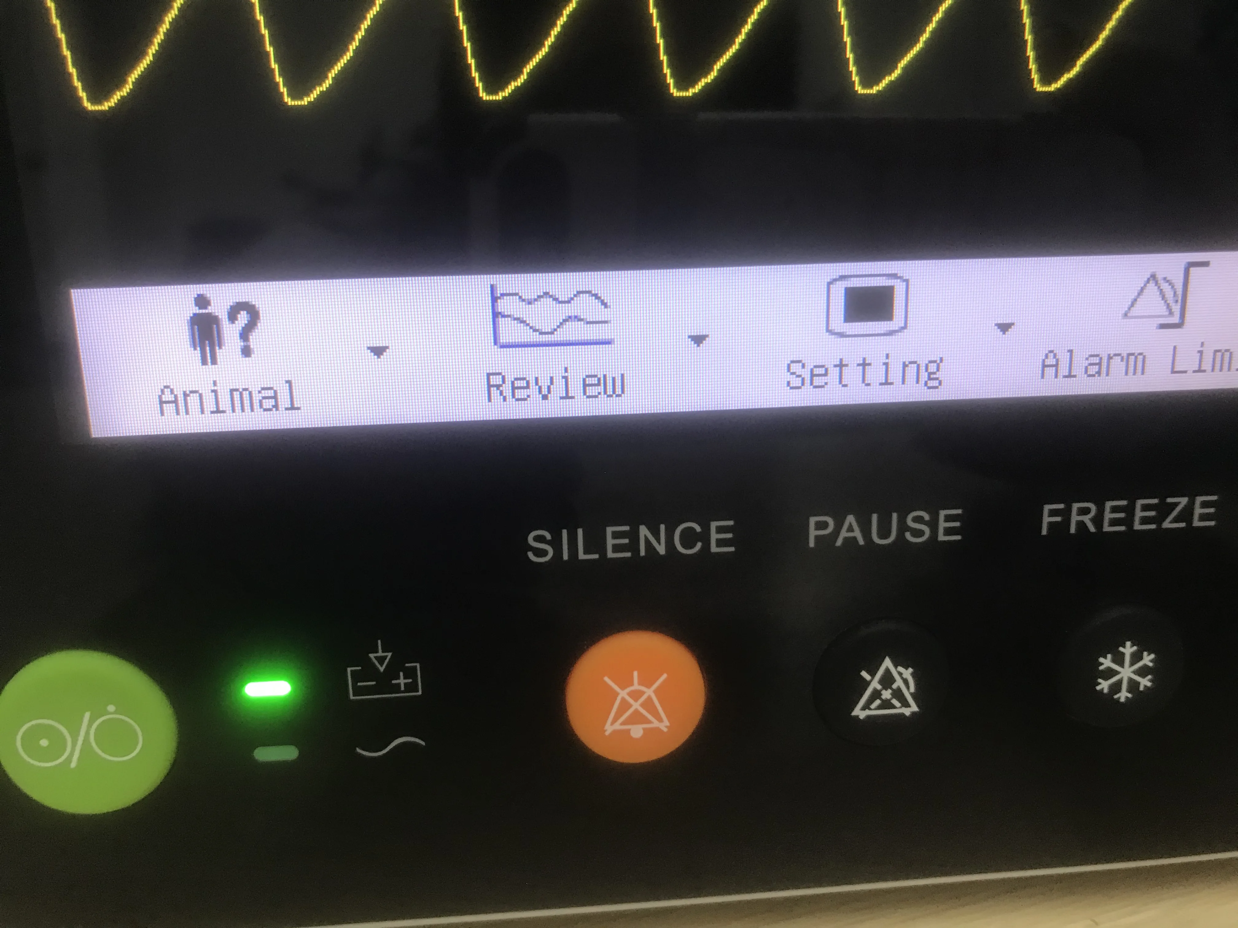Human designed six vet parameters patient monitor Sun-603S