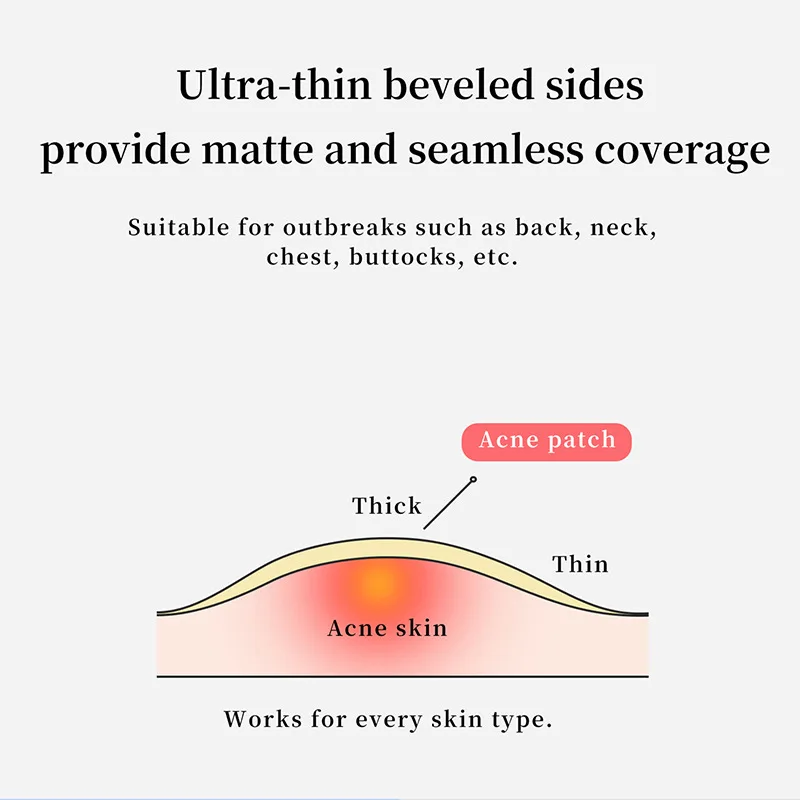 Prival Label Acne Patch for Acne Pimple Patch  Whitehead Absorbing Custom Skin Care Face Purifying Pores