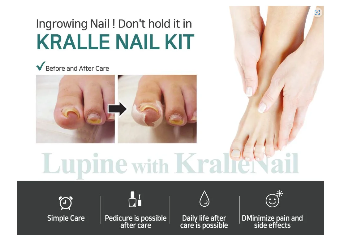 Dr. Kralle hurtless nail kit for ingrown toenail Korean curved toenail corrector simple to use safety and direct effect