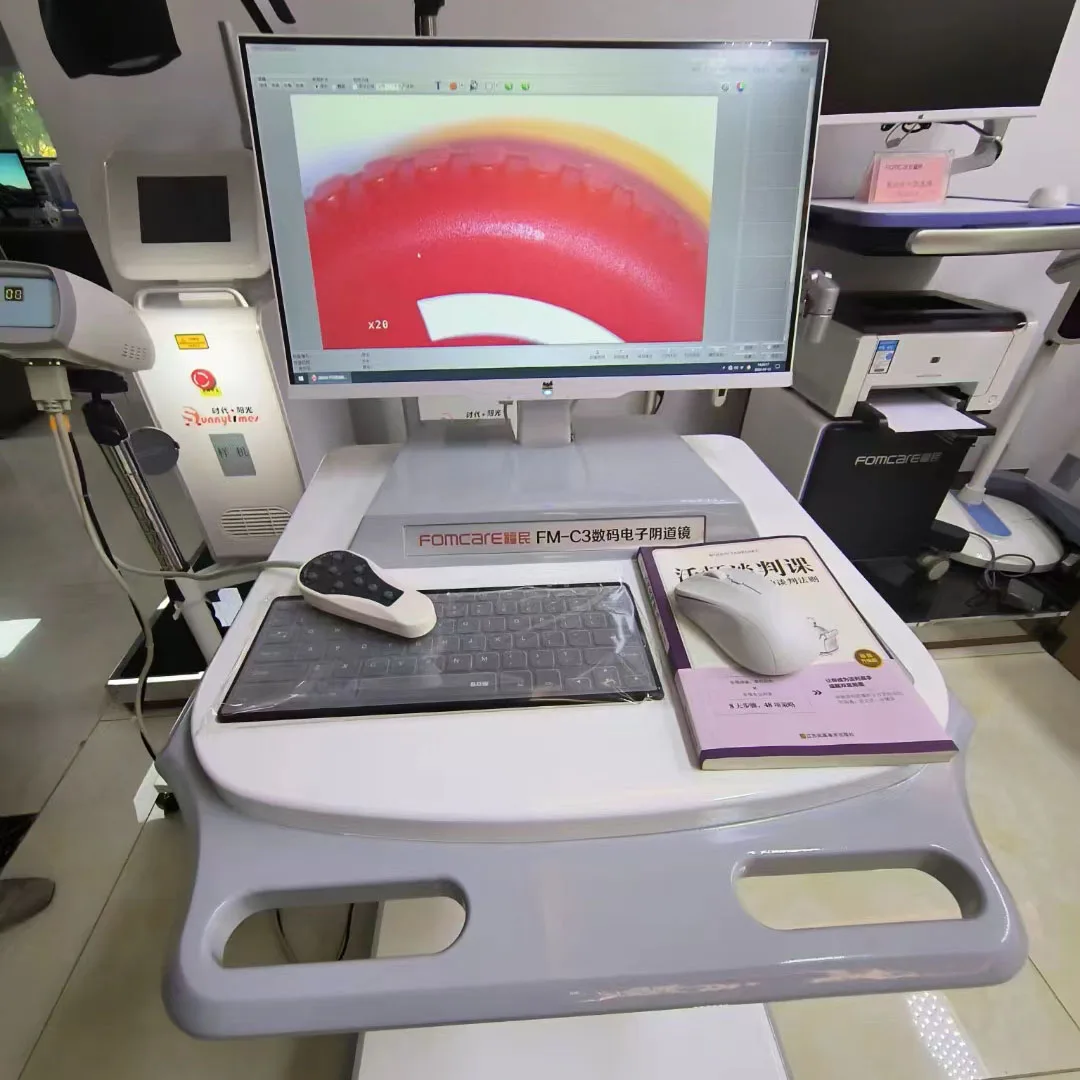 Aliroad FM-C3 Digital Colposcope Machine Digital Colposcope for Gynecology Wholesale Price Medical Digital Colposcope price