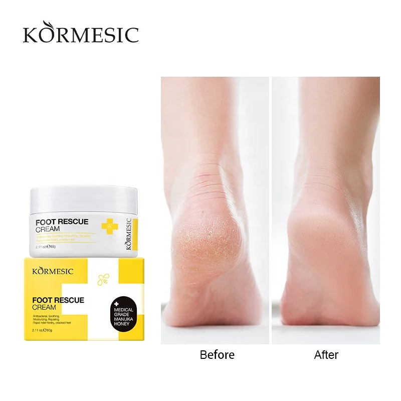 Foot Moisturizing Cream Non-Greasy To Improve Peeling And Chapped Foot Care Cream Foot rescue cream for Dry Cracked Feet Heels