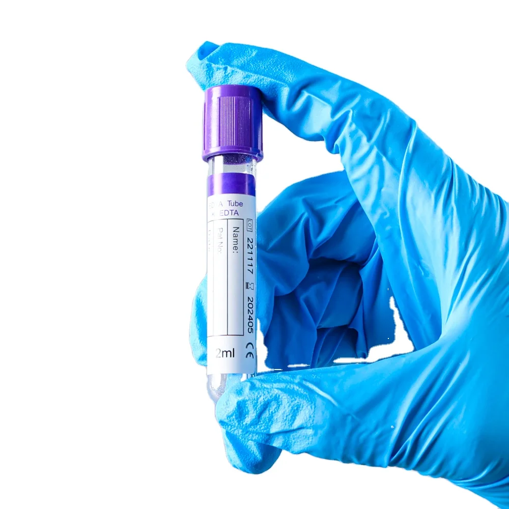 Factory medical 3ml 9ml 10ml vacutainer bd edta shortage coated micro prp tubes for blood collection