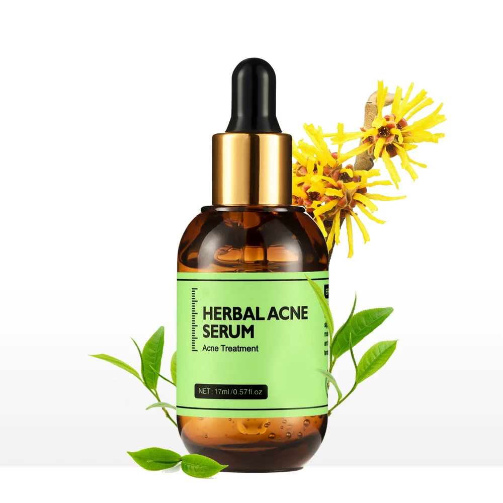 Acne Treatment Serum Private Label Acne Spot Serum Treatment Skin Care Acne Treatment Face Serum