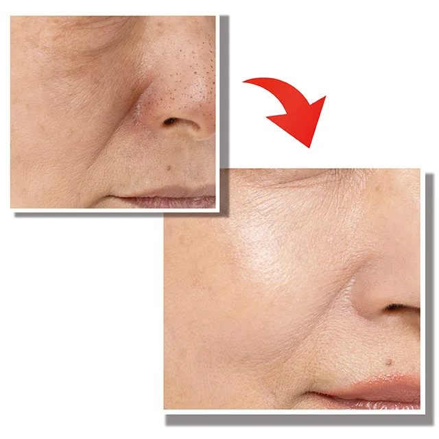 OEM Japan Best Selling HUMANANO Placenta Concentrated EGF Face Caring Pimple Anti Wrinkle Anti Aging Skincare Serum