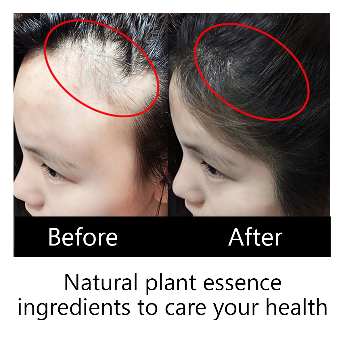 Organic Black Women Care Products Smoothing Scalp Treatments  Nourishing Regrowth Anti- Loss Hair Growth Serum