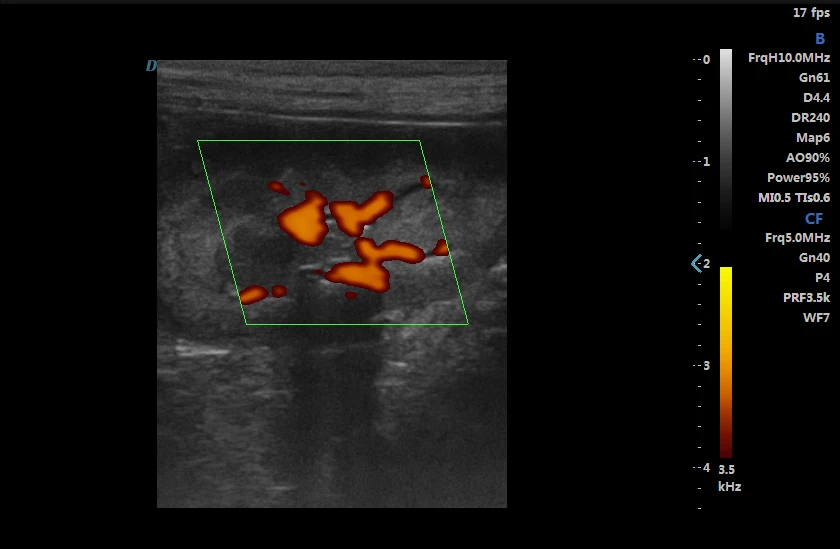 Dawei Tissue Doppler Imaging THI TDI Veterinary Color Doppler Ultrasonic System