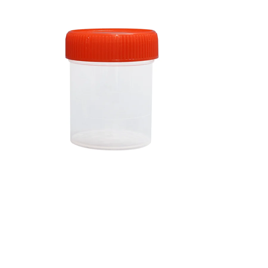Vietnam factory  plastic urine specimen collection with lid sterile OEM with cheap price- delivery quickly free tariff- M0261