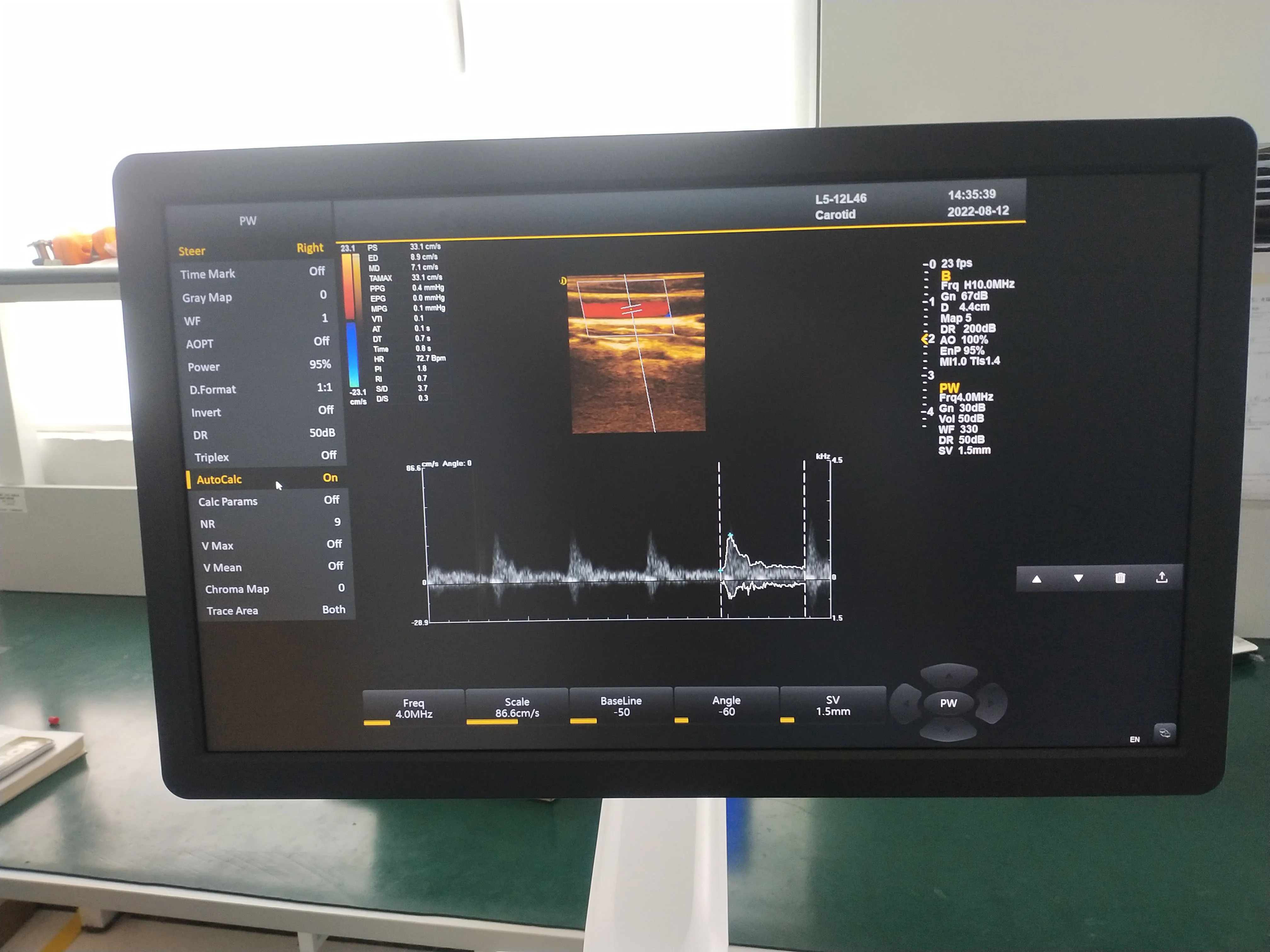Cost-effective color doppler ultrasound trolley for hospital diagnostic examination with 2B/4B imaging MSLCU10.