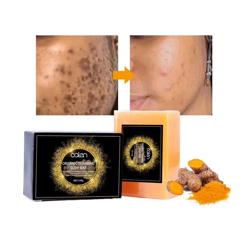 100% натуральное мыло ручной работы для отбеливания лица и тела лечение акне уход за кожей отбеливание
