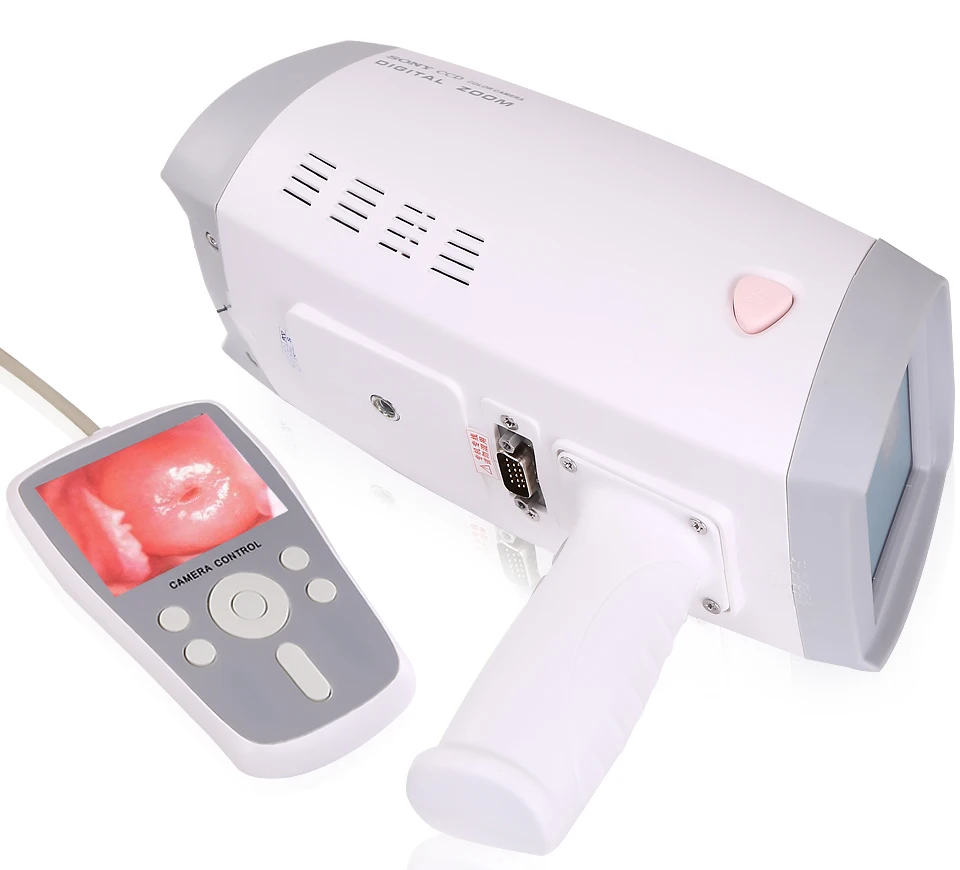 Digital Vaginal Speculum Camera Colposcope Digital Video Colposcope for Gynecology Gynecological ExaminationSIN-CE04