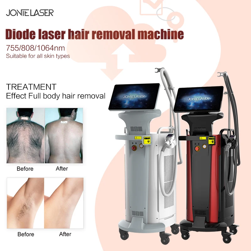 808nm depilator  depilation  755 808 1064 3 wavelength 808nm diode laser hair removal machine