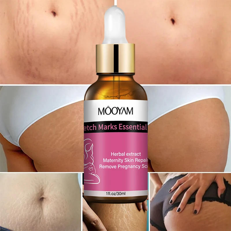 Private label OEM ODM reduce anti pregnancy stretch Pregnant belly stretch marks removal Pregnancy mark oil