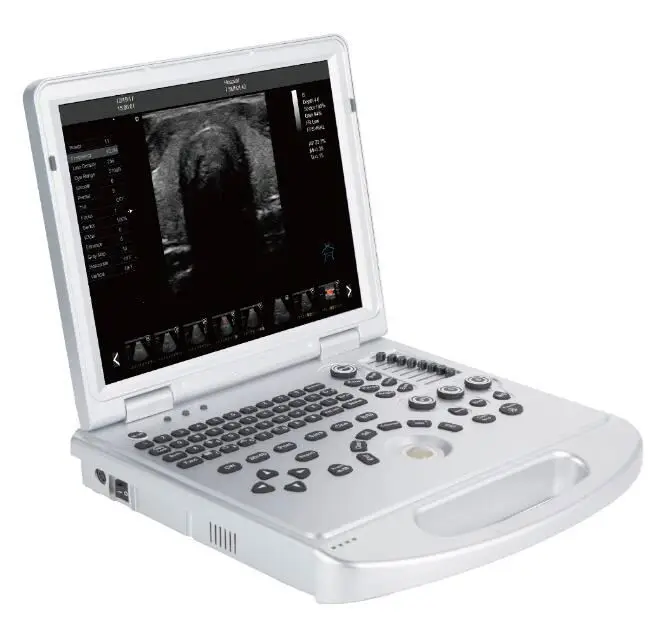 Usg machine 4d  3d ultrasound machine digital portable doppler ultrasound price