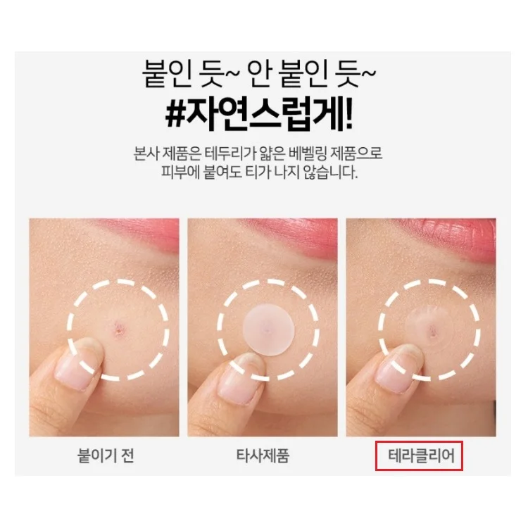 Korean Cosmetics Adhesive Zits Patch Circle Face Bandage Wound Coverage Skin Care Pimple Scarring Korea Beauty Pivate Label