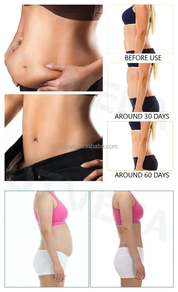 Частная этикетка OTVENA лучшая потеря веса тела сжигатель жира на животе сжигающий целлюлит горячий крем для похудения