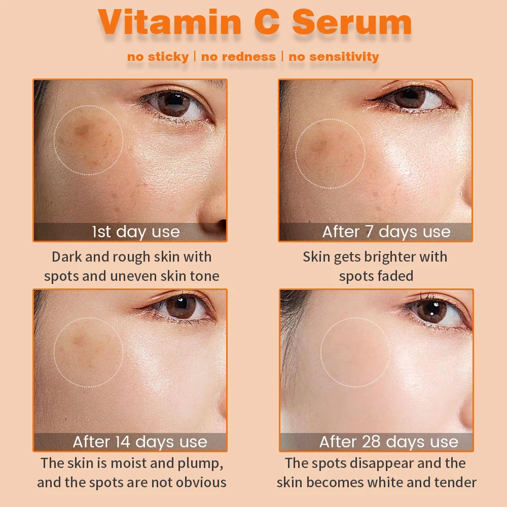 OEM Best Brightening Face Ascorbic Acid Vitamin C Whitening Serum Skin Care With Hyaluronic Acid For Dark Spots