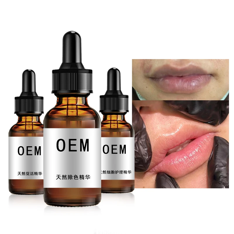 lip tattoo   lip color removal technology to change black lips