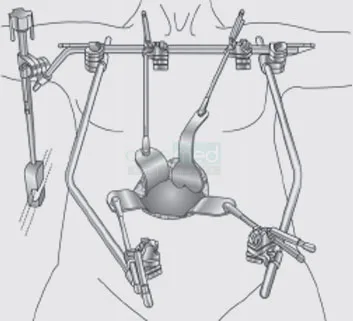 Top Manufacturer Thompson Retractor Set Wholesale Surgical Instruments In Best Rates | Caremed Instruments