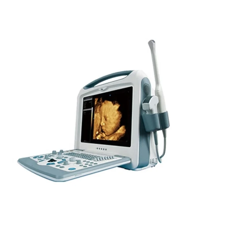 High Accuracy Factory price   CE Approved  medical  Ultrasound Scanner