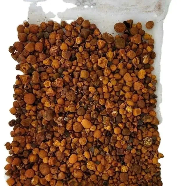 Продажа камней в желчном пузыре