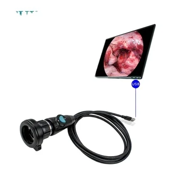 Portable Medical  Veterinary HD Endoscope Camera System 1080P USB 3.0 TU-LSD104B