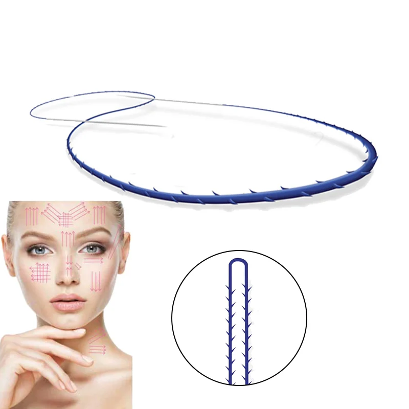 ce certificate face tightening medical suture facial v shaping twin thread lifting pdo double needle